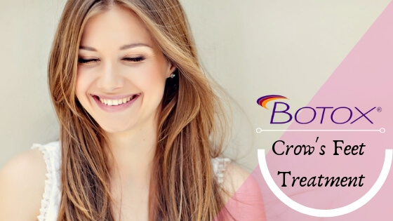 Is Botox Effective for Treating Crow’s Feet Around the Eyes?