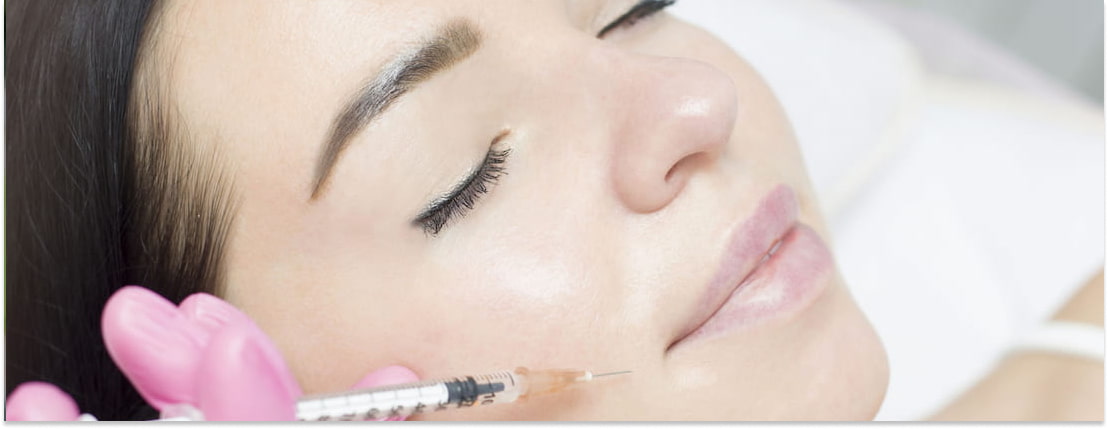 What Are Dermal Fillers?