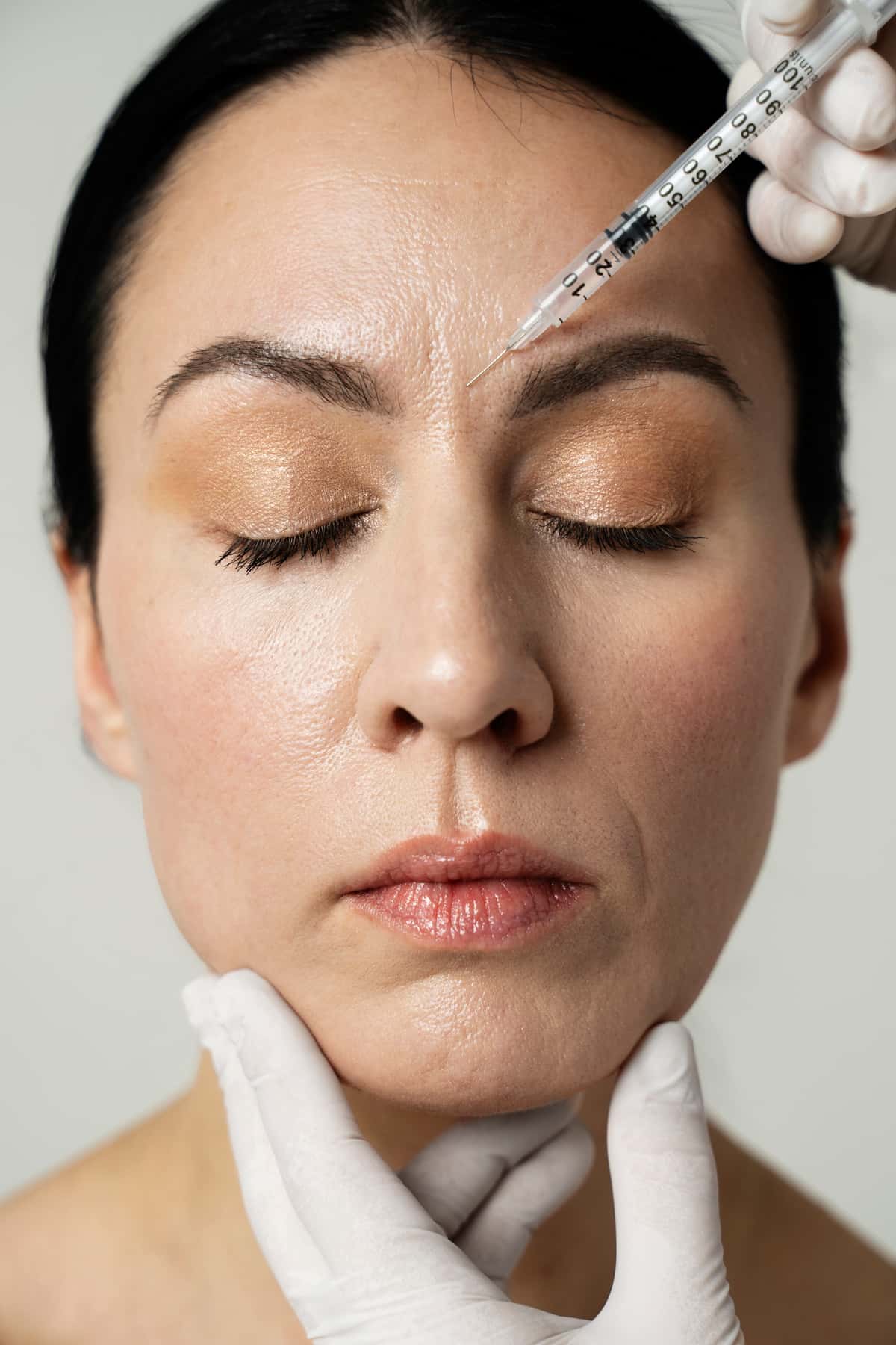 How Long Does Botox Last? FillerSupplies