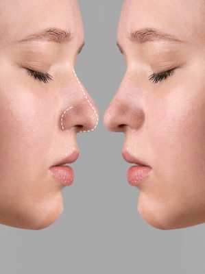 nose shape inkections