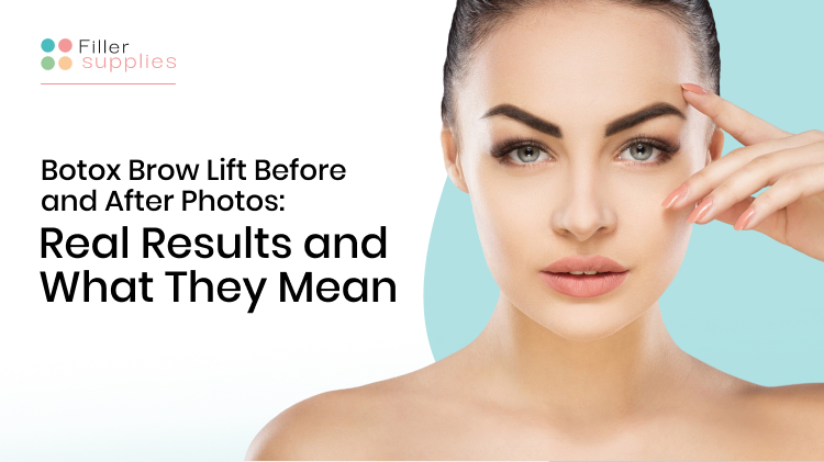 Botox Brow Lift Before and After Photos