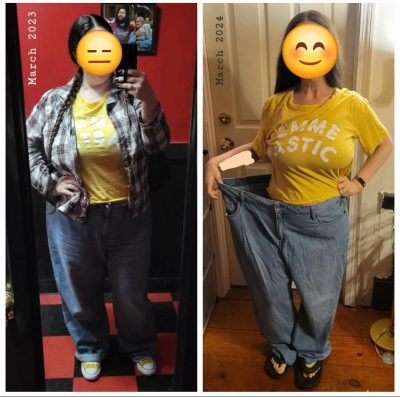 Wegovy before and after 2