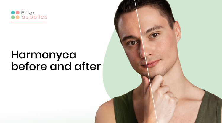 harmonyca before and after